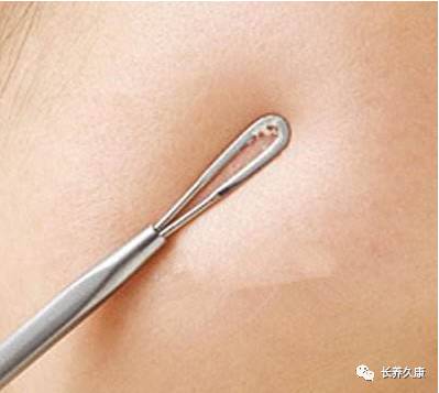 挤痘上瘾怎么办？用这些方法让你再不怕痘痕痘坑！