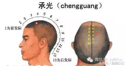 太阳穴头痛特效穴位图,中医头疼按压穴位