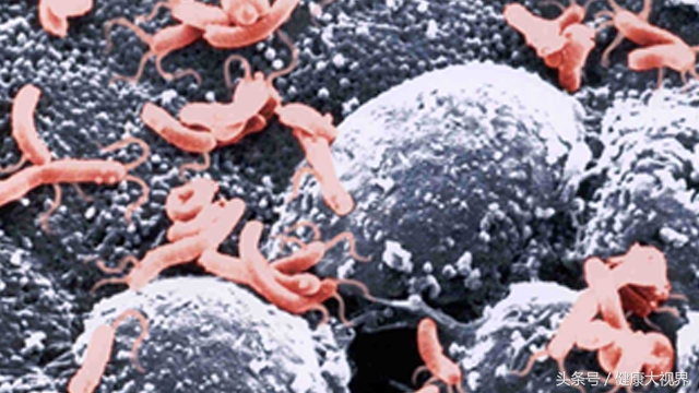 慢性胃炎螺旋杆菌一定要杀吗,慢性胃炎杀灭幽门螺旋杆菌会好吗