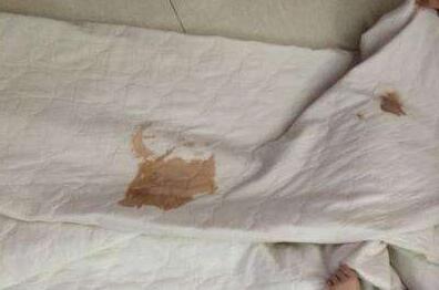 床单衣服有血渍不好洗怎么办,清洁床单血渍泡沫剂