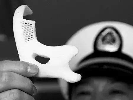 关于舌癌的新闻又一次刷屏，我想起了一年前离开的那位老人