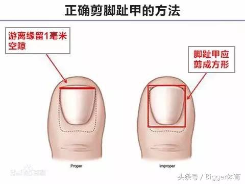 鞋带为什么总松开,为什么自己系的鞋带老是松开