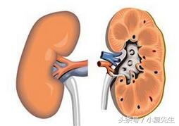 肾炎尿蛋白高怎么治,肾炎的中医辨证治疗方剂