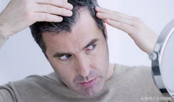 白头发长在头顶是什么原因,白头发长在两鬓是什么原因