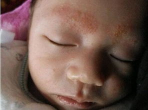 新手妈妈来围观：新生儿“胎毒”“胎垢”和胎脂到底该不该清除？