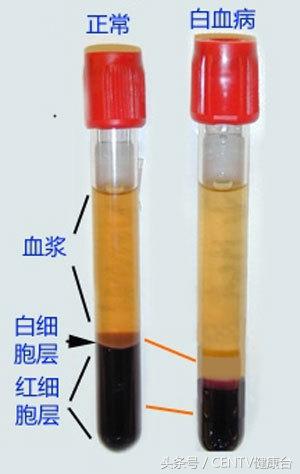 钻胯治病9元一次这样的奇耻大辱真的能治好白血病吗？