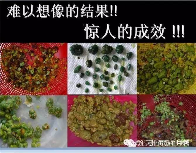 去美容院做肝胆肠排毒有哪些好处,美容院的肝胆排毒套盒有用吗