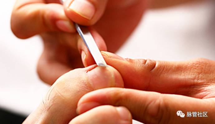 下肢发凉脚冰凉,下肢发凉是怎么回事呢