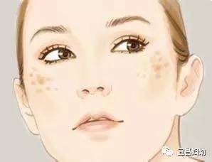 妇幼健康科普,哪个医院褐青色痣看得好