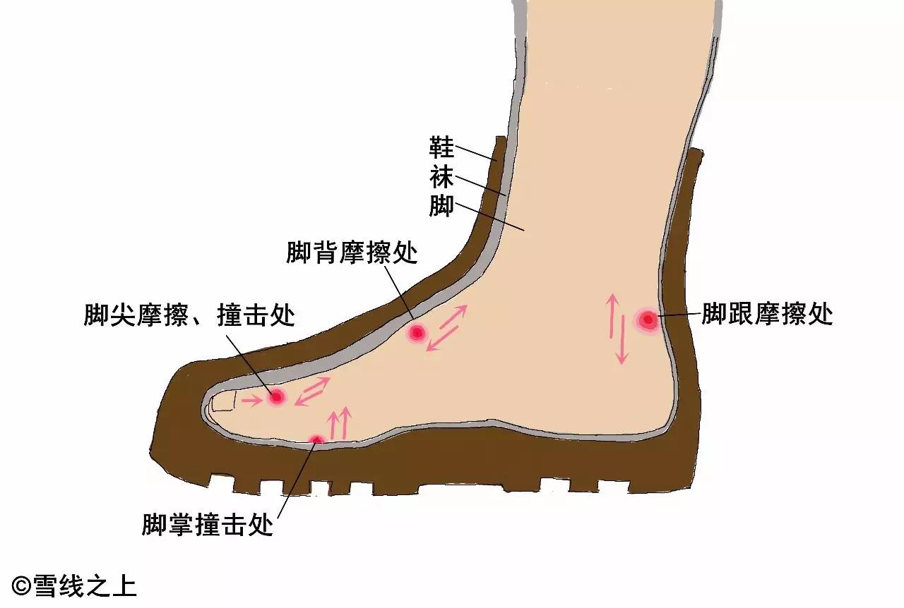 徒步走线时，如何防治水泡？