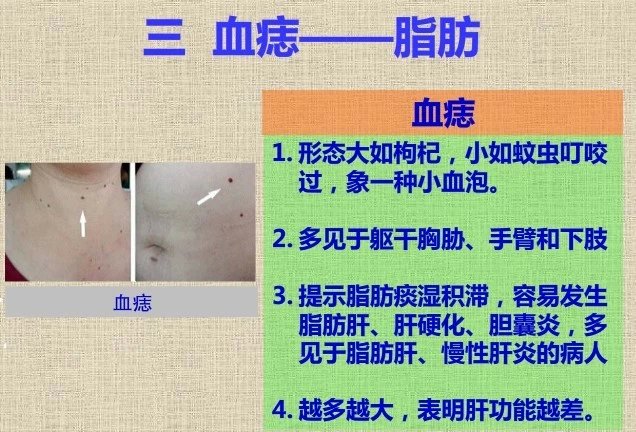 青筋跟血液循环有关吗,青筋的来源