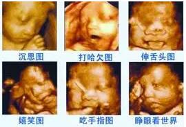 18周b超和四维彩超的区别,系统b超和四维彩超的区别