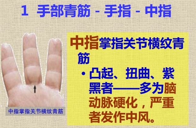 青筋跟血液循环有关吗,青筋的来源