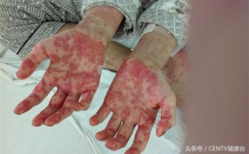 钻胯治病9元一次这样的奇耻大辱真的能治好白血病吗？