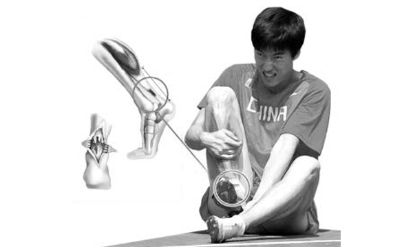 慢跑已经伤到膝盖怎么办,慢跑髌韧带拉伤