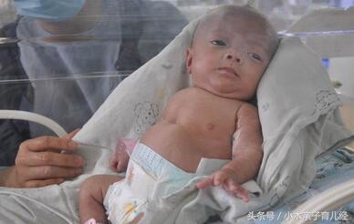 孕晚期最容易早产的8种孕妇,孕晚期哪些孕妇需要警惕早产