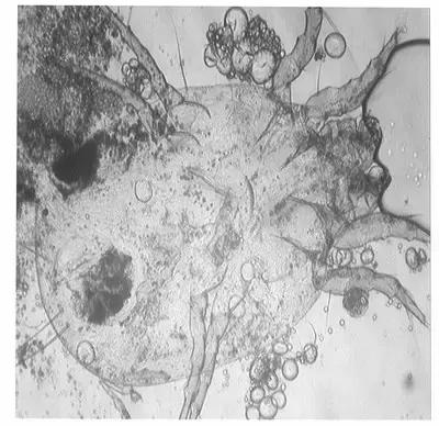 被子晒完太阳真的是螨虫的味道吗,晒过太阳的被子香味是螨虫尸体吗
