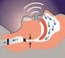 打鼾猝死几率高不高,打鼾致憋气停止怎么治疗