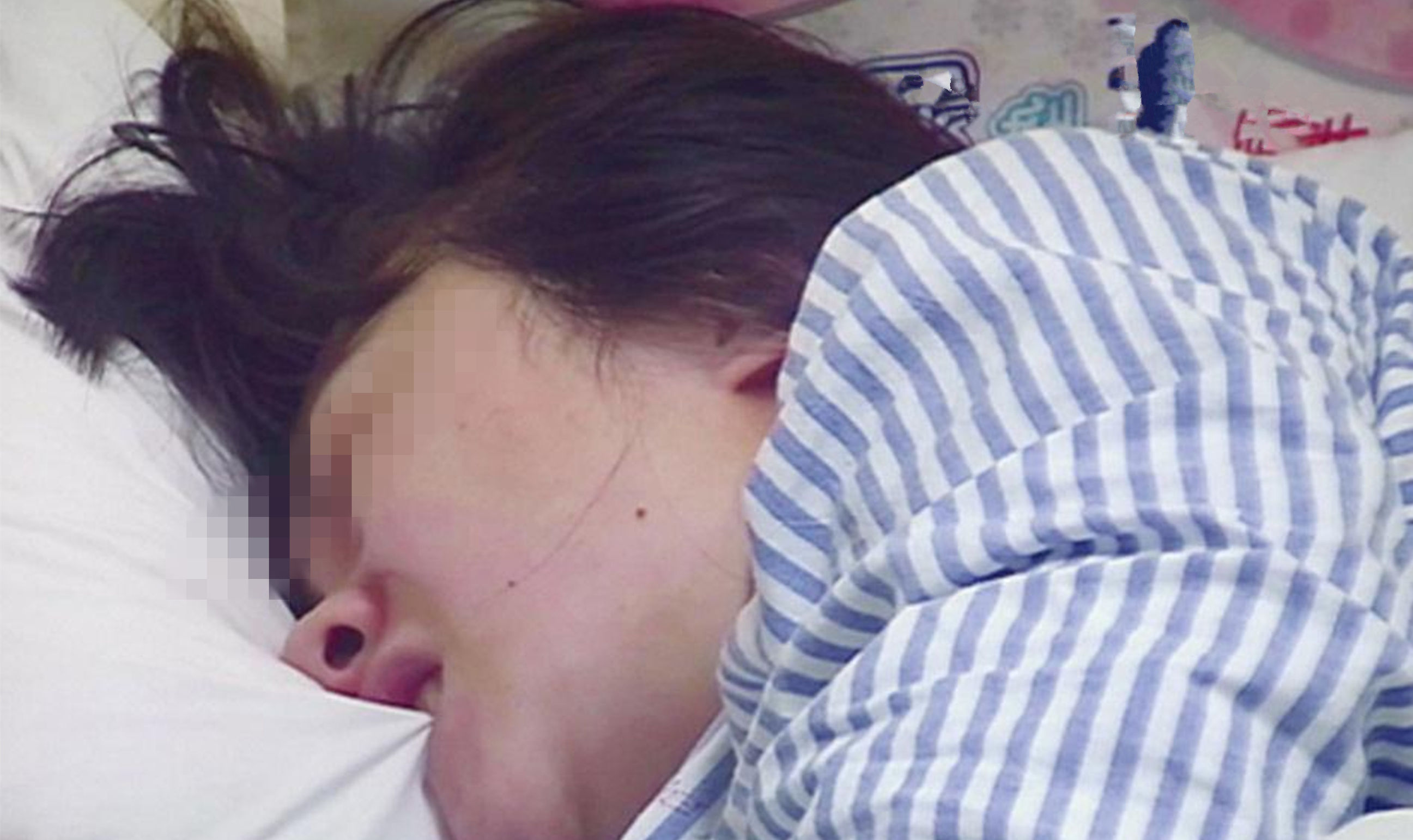 孕妇顺产撕裂几率,孕妇顺产撕裂