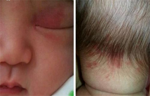 如何判断满月宝宝是否生病,宝宝满月的表现