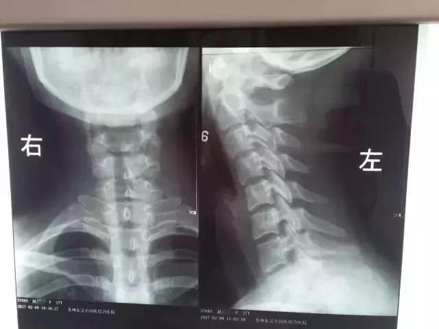 最新中医针灸治疗法,传承中医针灸调理技术