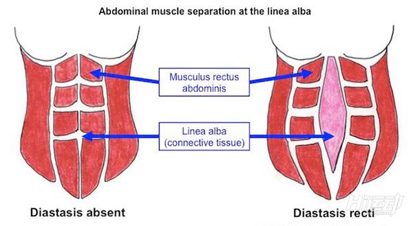 产后小腹紧致训练,产后小腹紧致的最快方法