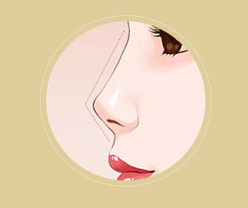 蒜头鼻鼻基底凹陷嘴凸,蒜头鼻和鹰钩鼻图片