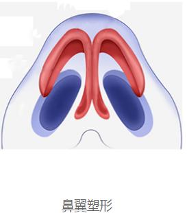 蒜头鼻鼻基底凹陷嘴凸,蒜头鼻和鹰钩鼻图片