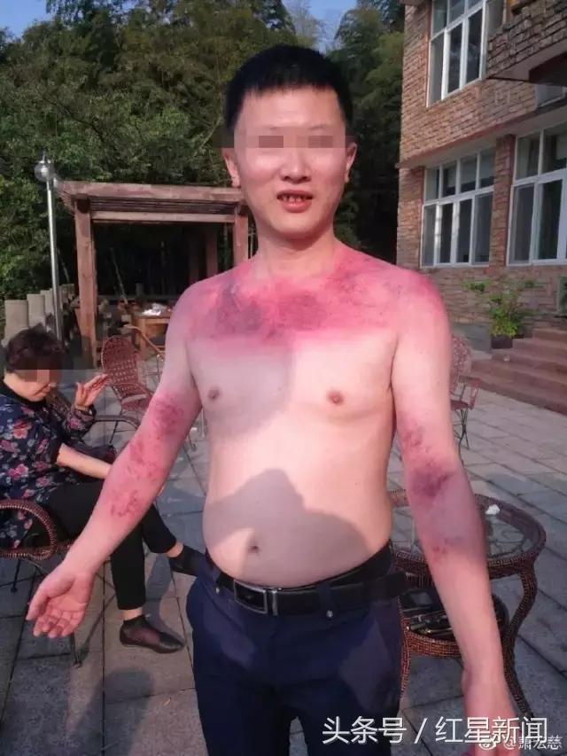 拍死7岁小孩“拍打拉筋神医”萧宏慈英国被抓粉丝仍力挺