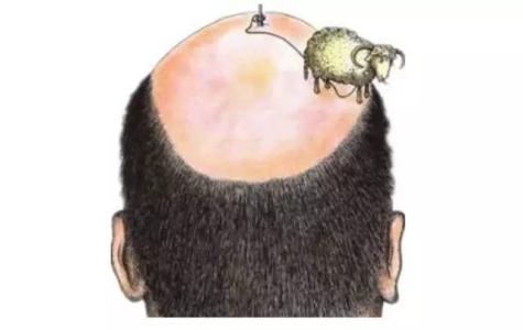 脱发严重这个防脱发妙招很好用,脱发怎么办8个防脱发妙招