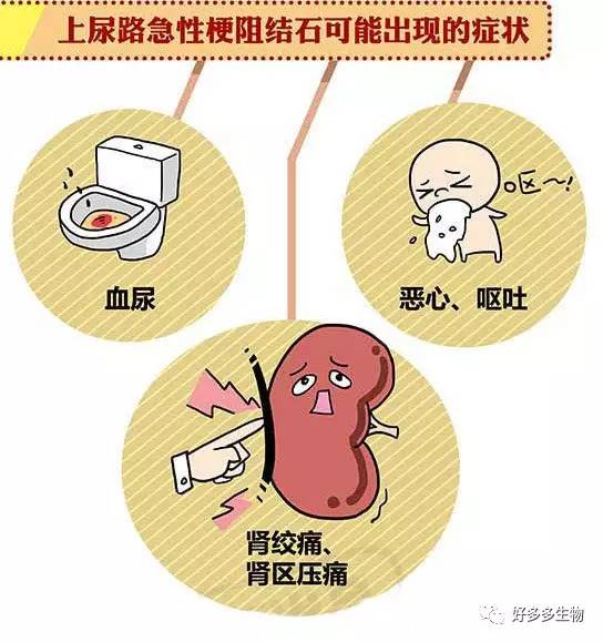 肾积水——尿都堵了，肾怎么能好