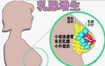 如何预防乳腺增生的保健操,预防乳腺增生的瑜伽动作