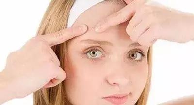 涨姿势与知识,青春痘攻克指南