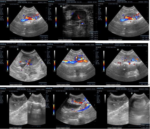 母猫乳腺肿块怎么治疗好,乳腺肿瘤最新研究结果