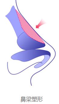 蒜头鼻鼻基底凹陷嘴凸,蒜头鼻和鹰钩鼻图片