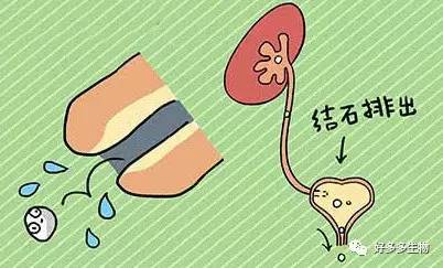 肾积水——尿都堵了，肾怎么能好