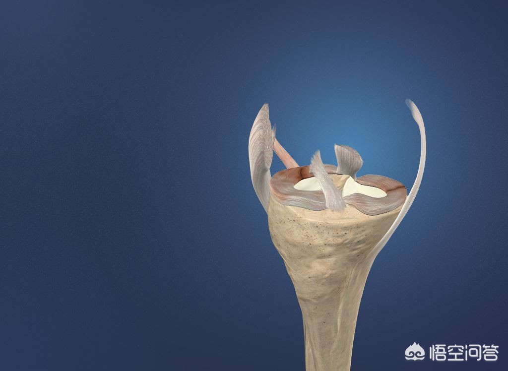 交叉韧带撕裂什么症状,交叉韧带撕裂怎么恢复正常