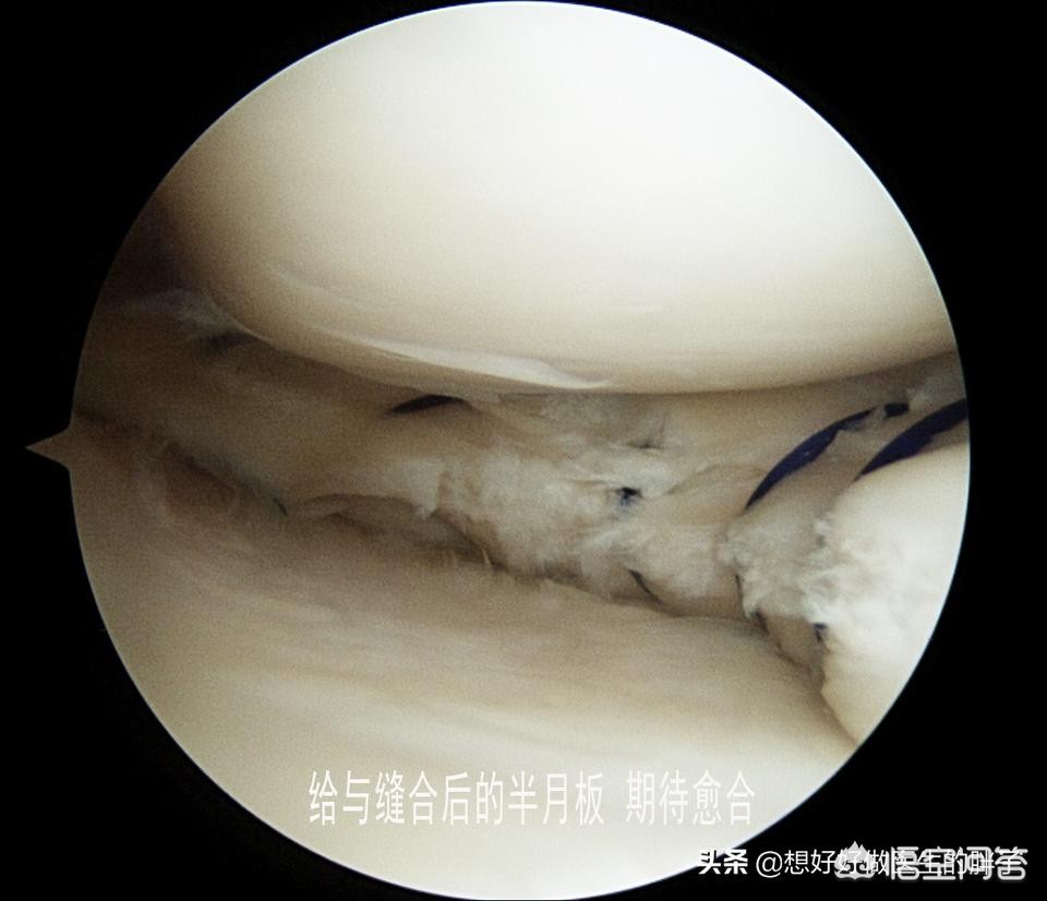 膝关节痛上下楼梯痛教你一招缓解,走平路时膝关节疼痛是什么原因