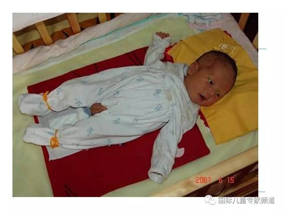 「PPT干货」国际儿童专家频道学术讲座.NO7——浙江大学医学院附属儿童医院消化科，陈洁主任主讲《婴儿胆汁淤积性肝病的诊治》