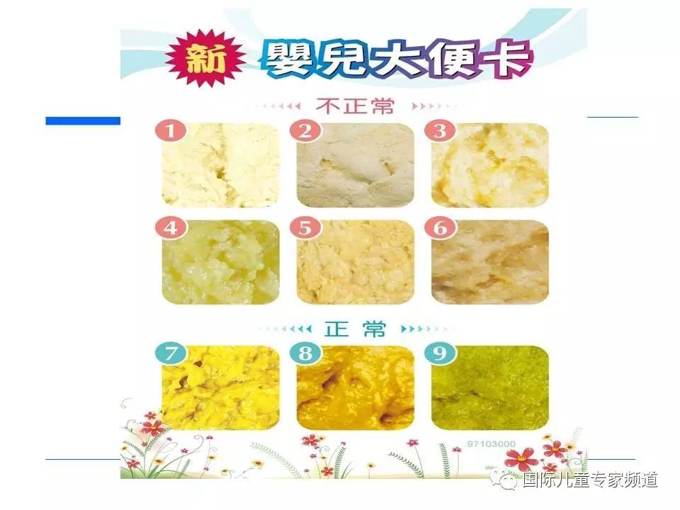 「PPT干货」国际儿童专家频道学术讲座.NO7——浙江大学医学院附属儿童医院消化科，陈洁主任主讲《婴儿胆汁淤积性肝病的诊治》