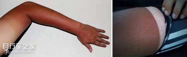 被晒伤了如何急速修复,多肉晒伤严重最快修复方法