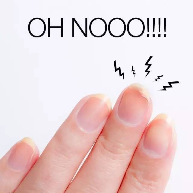 指甲从根部断裂去除断甲,指甲断裂在家自己怎么修补