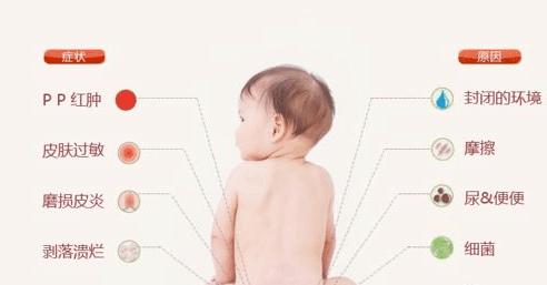 天天兜尿不湿宝宝红屁股了，该怎么办？