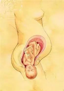 助产士教你正确分娩,金牌助产士简要事迹