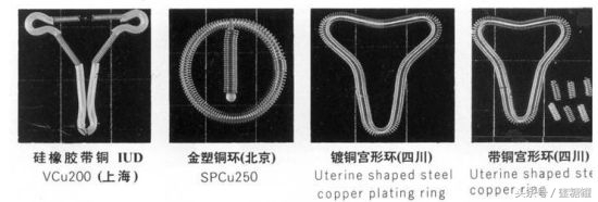 上环避孕会宫外孕吗,上环会生宫颈囊肿和子宫肌瘤吗