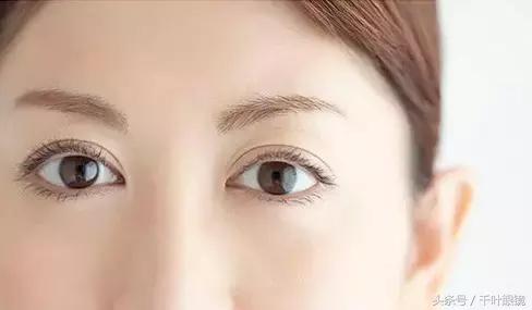 为什么佩戴隐形眼镜后眼睛会有*血丝红**？