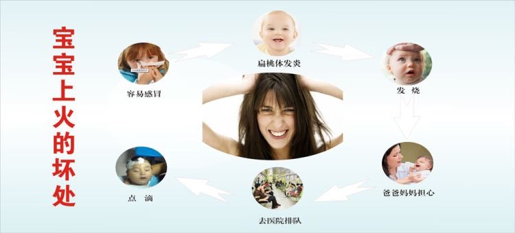 宝宝上火口腔溃疡,宝宝上火的症状