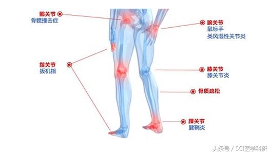 膝盖活动的时候有脆响,活动时膝关节发出响声是怎么回事