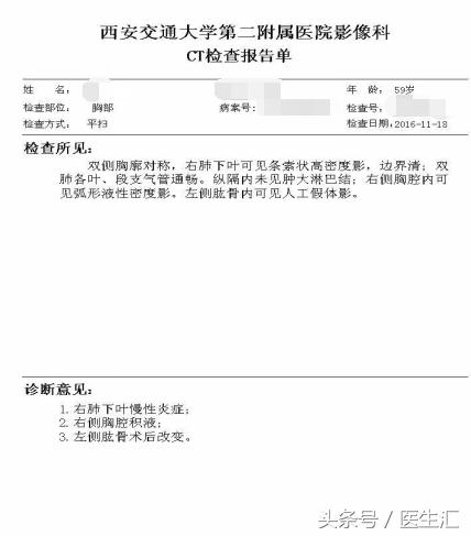 胸痛可能是肺的原因吗,胸痛咯血