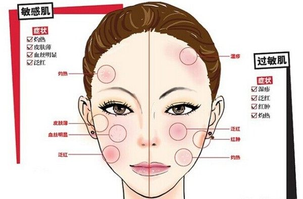 敏感肌即刻舒敏修护面膜,修复补水舒敏面膜